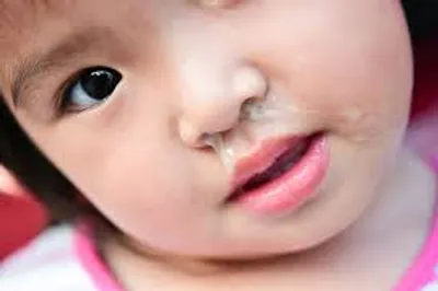 Illustration snot - Image 2