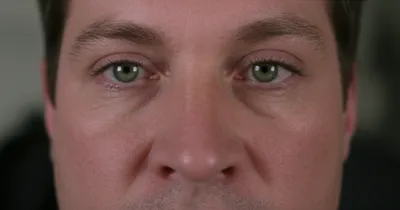 Illustration squints - Image 1