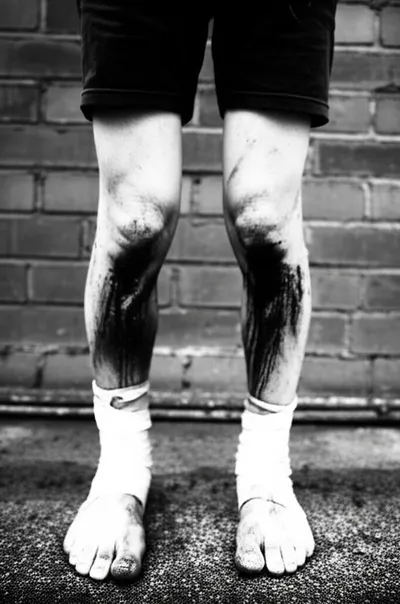 Illustration kneecap - Image 1