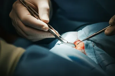 Illustration gorget - Image 1