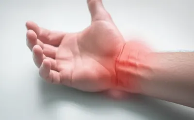 Illustration swelling - Image 1