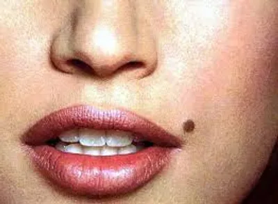 Illustration mole - Image 2