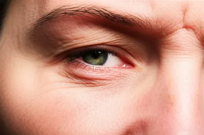 Illustration squint - Image 1