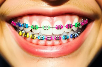 Illustration braced - Image 1