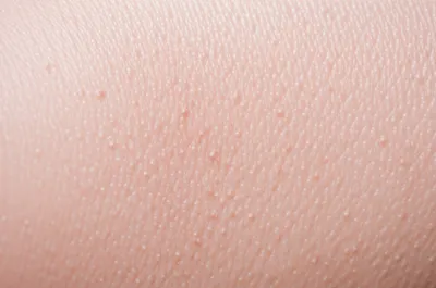 Illustration nettle - Image 1