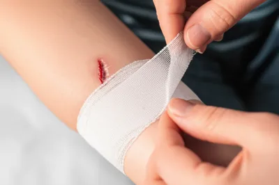 Illustration gauze - Image 1