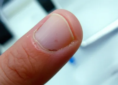 Illustration felon - Image 1