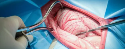 Illustration retractor - Image 1