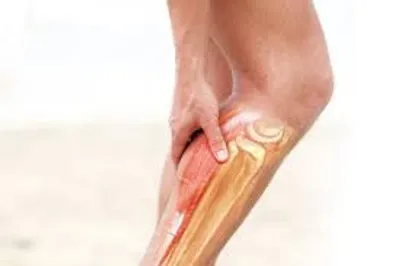 Illustration cramp - Image 2