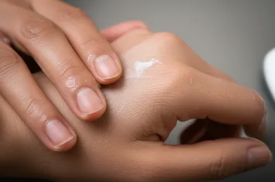 Illustration emollient