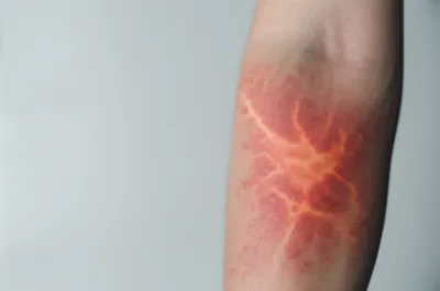 Illustration wildfires - Image 1