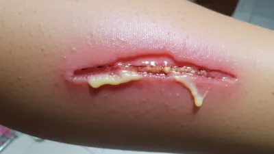 Illustration running - Image 1