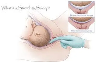 Illustration sweep - Image 4