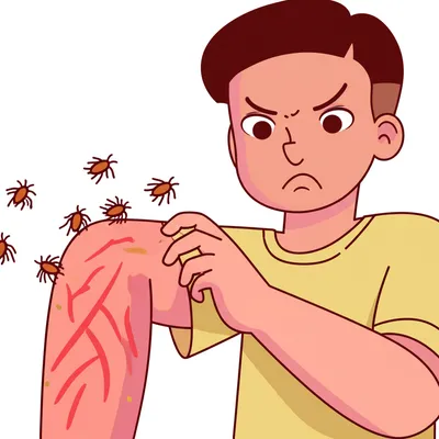 Illustration itched - Image 1