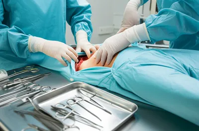 Illustration postmortem - Image 1