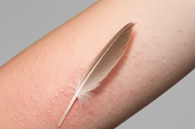 Illustration irritant - Image 1