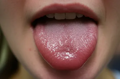 Illustration salivary - Image 1