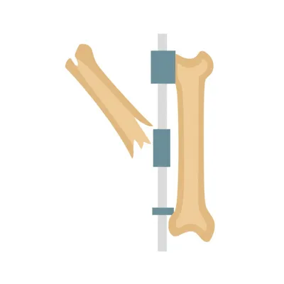 Illustration reduce - Image 1