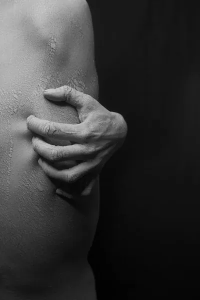 Illustration itched - Image 2