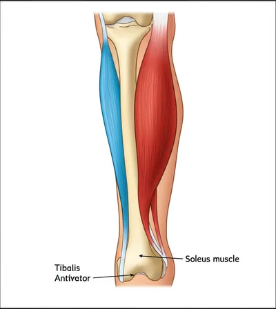 Illustration tibiales
