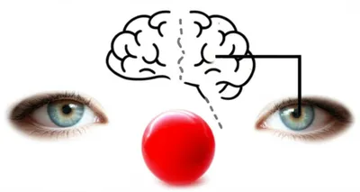 Illustration amblyopia - Image 1