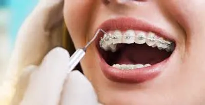 Illustration orthodontics - Image 2