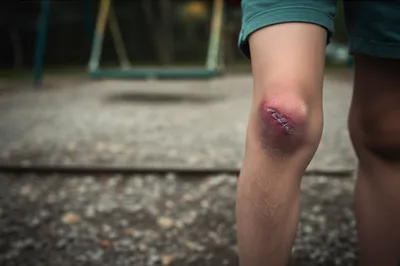 Illustration scraped - Image 1