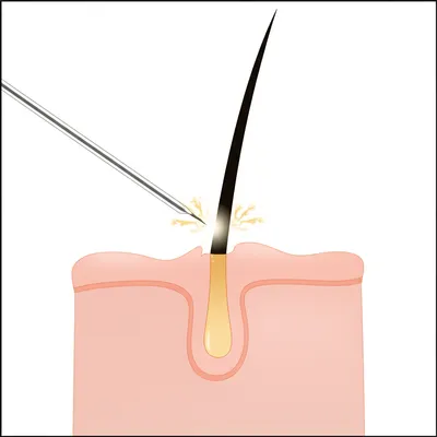 Illustration electrolysis - Image 1