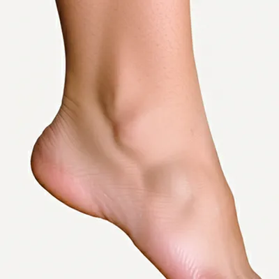 Illustration malleolus