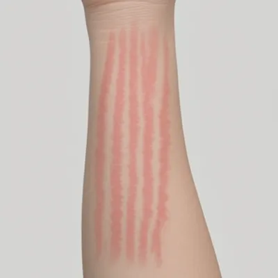 Illustration welts - Image 1