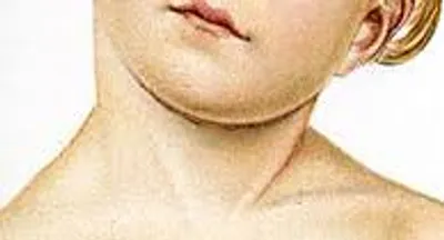 Illustration wry - Image 3