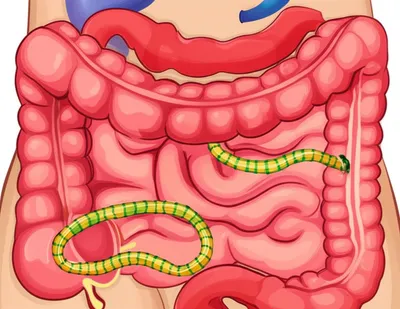 Illustration taenia - Image 1