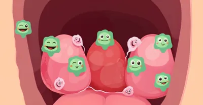 Illustration tonsil - Image 1