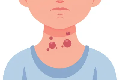 Illustration cruels - Image 1