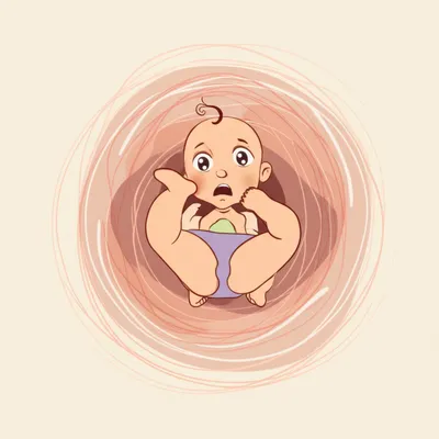 Illustration breech - Image 1