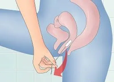 Illustration tampon - Image 2