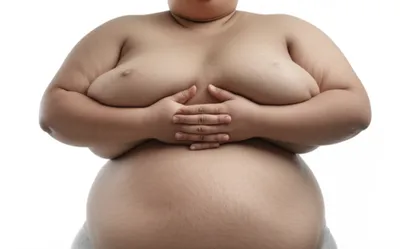 Illustration obesity - Image 1