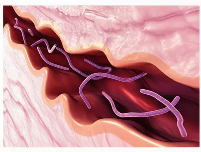 Illustration threadworm