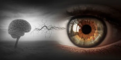 Illustration glaucoma - Image 1