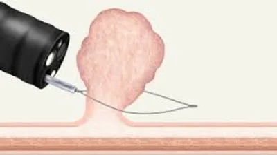 Illustration snare - Image 3