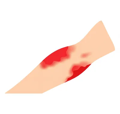 Illustration nettle - Image 1