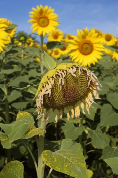 Illustration lymphatic - Image 1