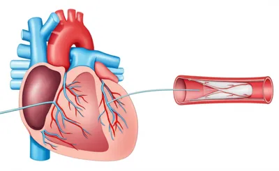 Illustration balloon - Image 1