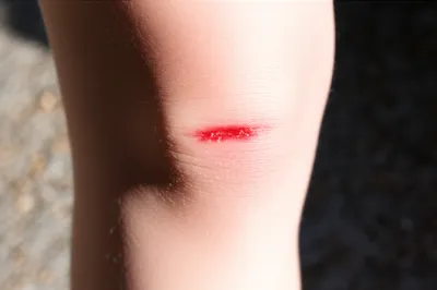 Illustration creased - Image 1