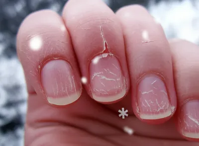 Illustration chapped - Image 1