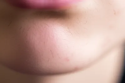 Illustration down - Image 1