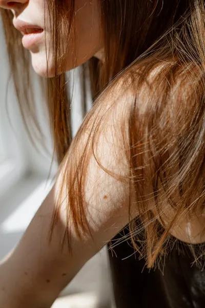 Illustration birthmarks - Image 2