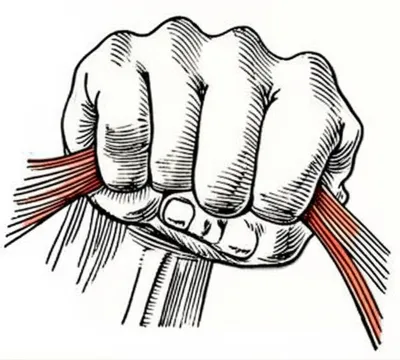 Illustration cramping - Image 1