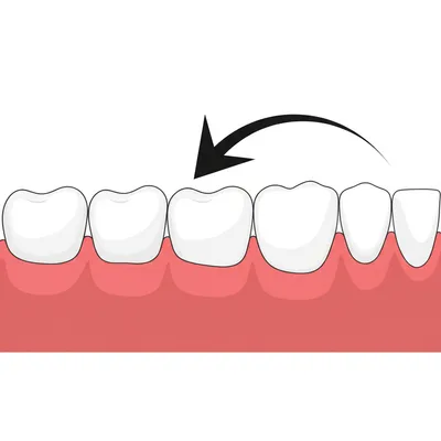 Illustration mesial - Image 1