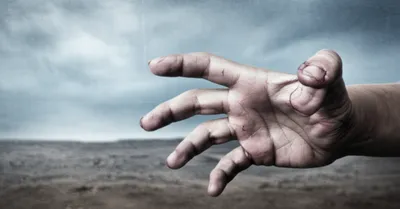 Illustration sore - Image 1